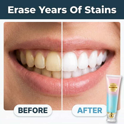 SmileBright™ - Instant Whitening & Enamel Care