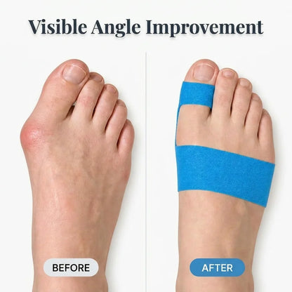 Quietstep™ – Elastic Bunion Relief Wrap