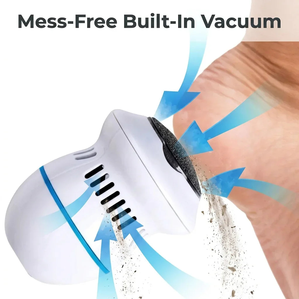 CallusClear™ - Rechargeable Electric Foot Smoother