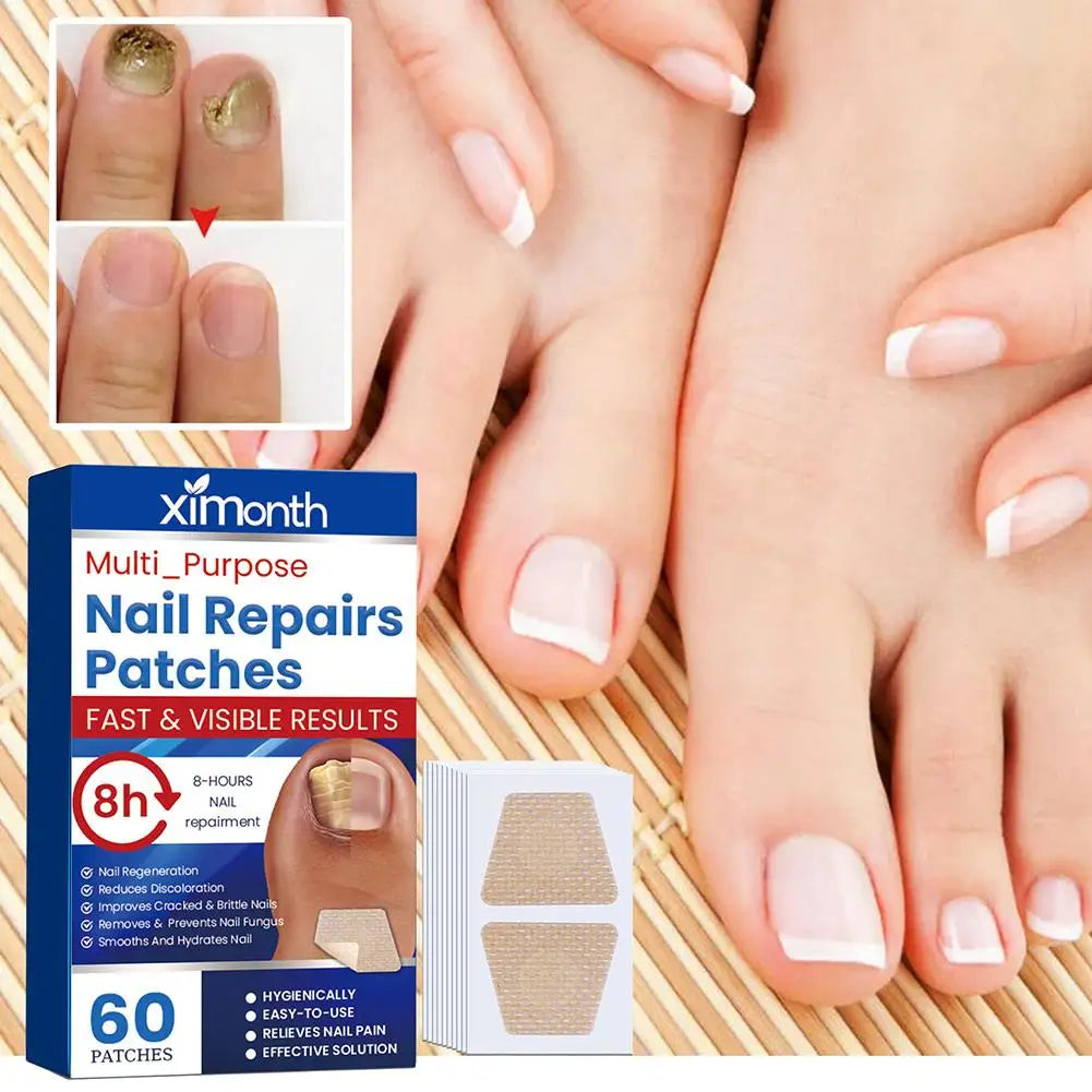 HealthyNail™ Fungal Nail Restoration Patches - Restore Clear, Healthy Nails Discreetly