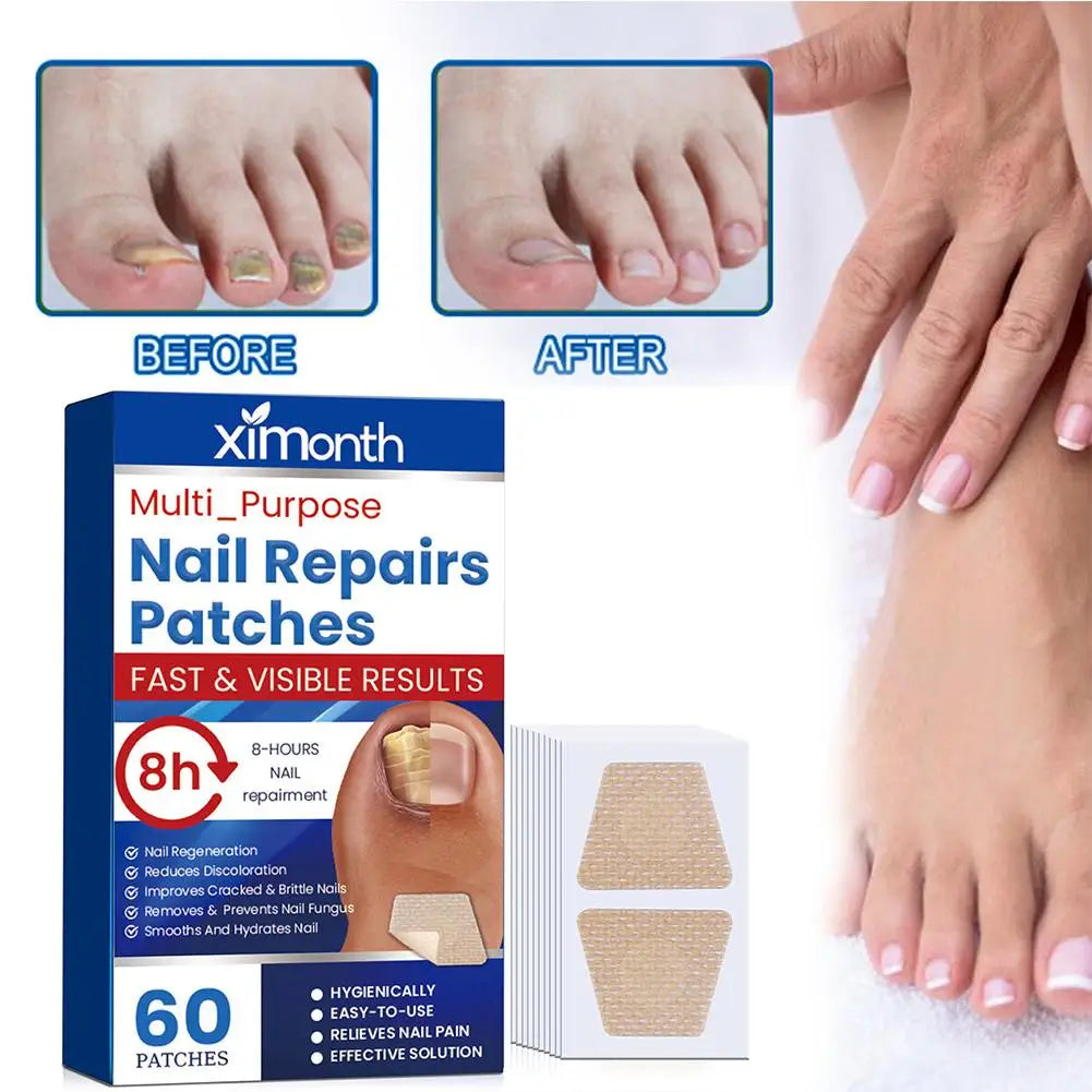 HealthyNail™ Fungal Nail Restoration Patches - Restore Clear, Healthy Nails Discreetly
