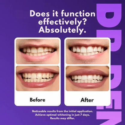 TrueWhite™ - A perfect smile in just 30 minutes